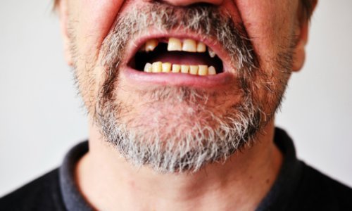 Njemački stomatolozi otkrili kako se može sačuvati izbijeni zub