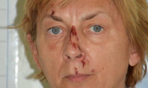 Prepoznajete li ovu ženu? Pronađena je na Krku, a ona se ne sjeća tko je