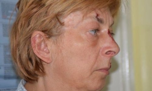 Policija prima dojave iz cijeloga svijeta o misterioznoj ženi pronađenoj na Krku