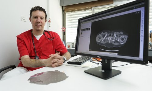 Srića odgovorio Milanoviću: Dok se on na nedopustivom mjestu u 'Klubu' družio s Kovačevićem, ja sam spašavao živote