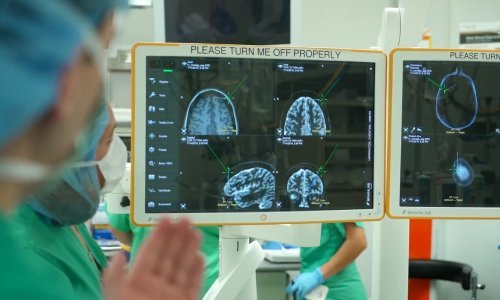 U Hrvatskoj je lani od moždanog udara umrlo 4950 osoba. Otkrijte koji su rani simptomi