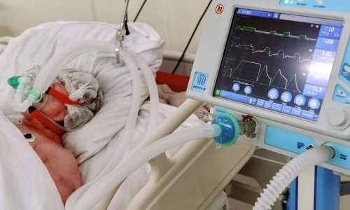 Pozitivnih više nego krajem 2020., upola manje hospitaliziranih, ali smrtnost je i dalje velika