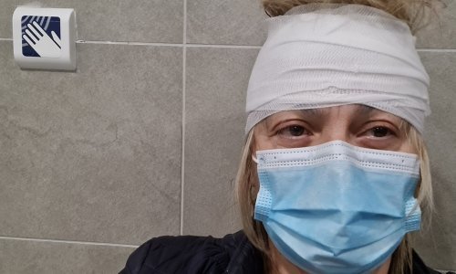 Dogradonačelnica Gline završila na Hitnoj: 'Tvrda glava polomila crijep'