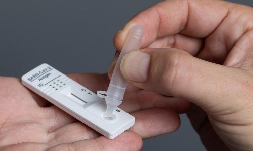 Ekspolodirala potražnja; u Hrvatskoj u tri mjeseca prodano milijun kućnih testova na covid