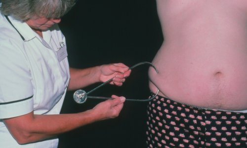 Tin je imao 239 kg, ostao je bez sluha i vida. Spasila ga je operacija