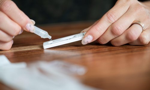 HZJZ pojasnio što je vjerojatan slučaj covida-19