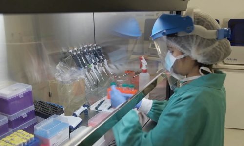 Moždane komplikacije zabilježene kod jedan posto hospitaliziranih od koronavirusa