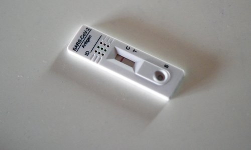 HZZO: Cijena brzog testa protiv covida 62 kune