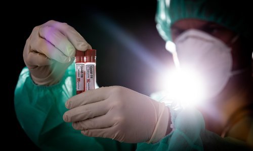 Stručnjaci: Širenje omikrona vidjet ćemo u vrijeme nove godine