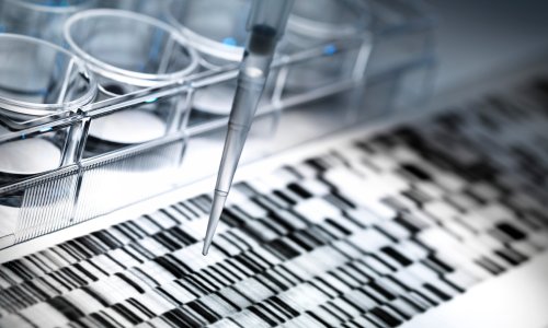 U masovnoj grobnici pronađeni ostaci još 10 žrtava genocida u Srebrenici