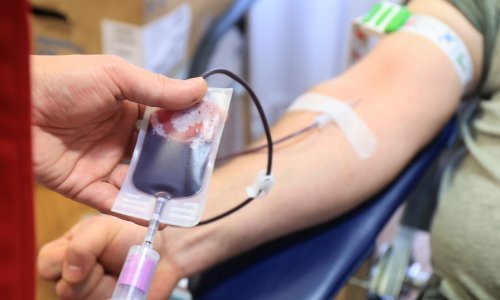 Apel iz Rijeke darivateljima krvi: Nedostaju krvne grupe A+ i B+