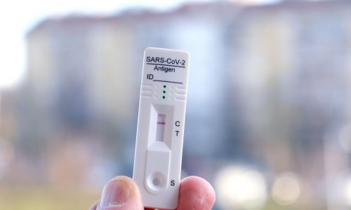 Hrvatska predložila da se kao dokaz o preboljenju priznaju rezultati antigenskih testova