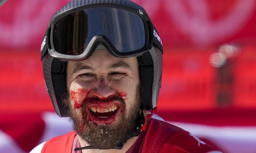 [FOTO] Kakav olimpijski duh! Za vrijeme utrke unakazio si je lice, nije mogao disati od krvi, ali nije odustao...