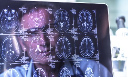 Istraživanje pokazalo da nam zaista prije smrti cijeli život 'proleti' pred očima