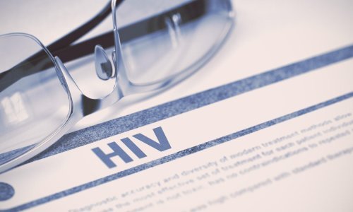 Zaraza HIV-om u europskim se zemljama često prekasno otkrije