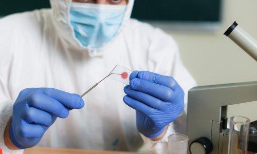 WHO pozvao Ukrajinu da uništi patogene koji se čuvaju u laboratorijima