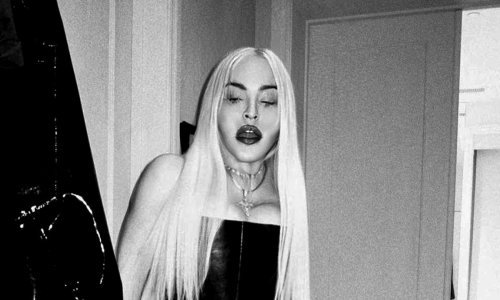 [FOTO] Madonna izgledom i ponašanjem izaziva jezu: Lice joj pati zbog silnih plastičnih operacija, filera i botoksa