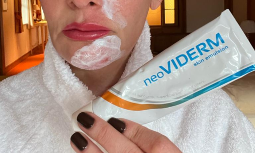 Kako u 2 dana od ozljede do jedva vidljive rane?