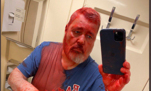 Glavni urednik Novaje Gazete, nobelovac Muratov, u vlaku zaliven crvenom bojom: 'Oči me užasno peku'