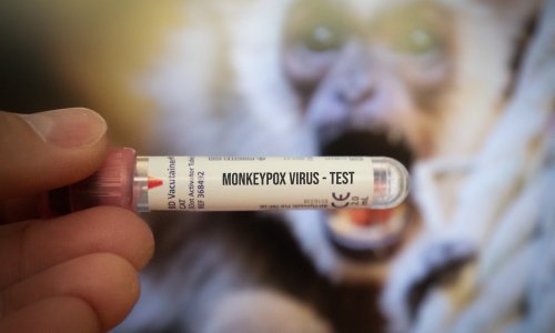 Počelo cijepljenje protiv majmunskih boginja u Europi; zalihe cjepiva su ograničene