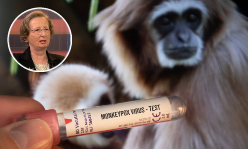 Alemka Markotić objavila detalje simptoma zaraze majmunskim boginjama, istaknula je da je smrtnost oko deset posto