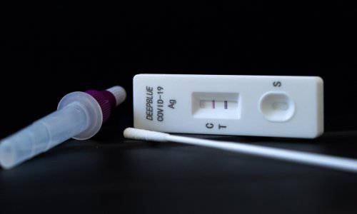 Stručnjak objašnjava: Zašto neki ljudi nisu 'pokupili' koronavirus?