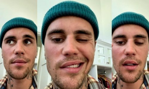 Justin Bieber otkrio da oporavlja od paralize lica, u video je pokazao o kakvom se stanju radi: 'Kao što vidite ne mogu trepnuti niti se nasmijati'