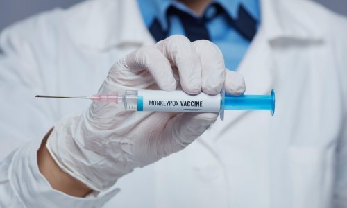 Majmunske boginje mogu se širiti i prije pojave simptoma
