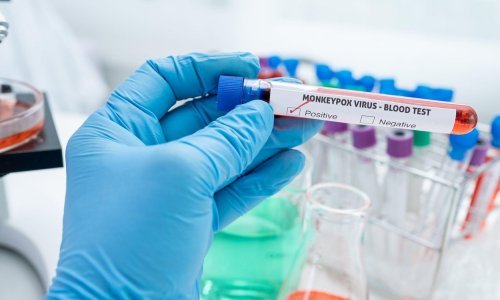 Nakon Španjolske i Brazila i Indija potvrdila prvu smrt od majmunskih boginja, što je prvi takav slučaj u Aziji