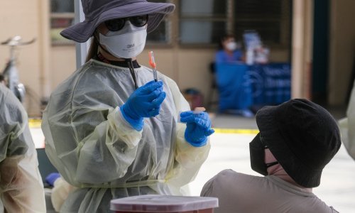 U SAD-u potvrđeni prvi slučajevi majmunskih boginja kod djece