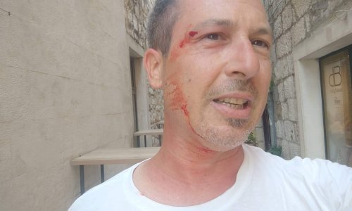 'Snimio sam psa kako na Rivi obavlja nuždu, a kad sam sreo vlasnika on me napao. Prijave smo zaradili obojica, ja zato što sam se branio'