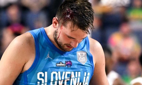 [FOTO] Luka Dončić je 'monstrum'! Francuzi ga tukli, razbili mu glavu, a on im utrpao više od polovice koševa!
