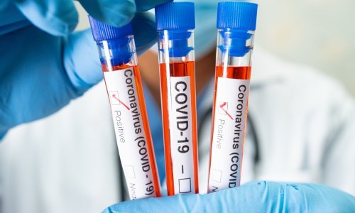 WHO: Covid-19 još je uvijek hitan zdravstveni problem