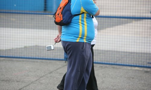 Pet kilograma više u srednjoj dobi povećava izglede za operaciju koljena za 30 posto