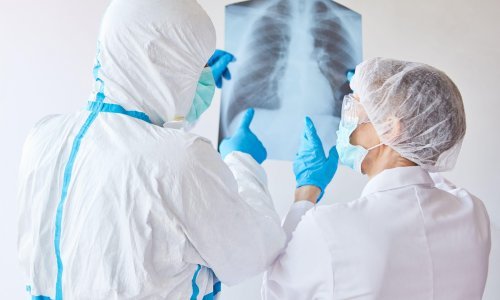 Zbog korone smanjen očekivani životni vijek u EU, dvostruko više tinejdžera sa simptomima anksioznosti