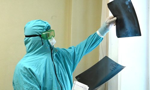 Oboljeti od covida dva, tri ili više puta nosi sa sobom gore posljedice nego što smo ranije mislili