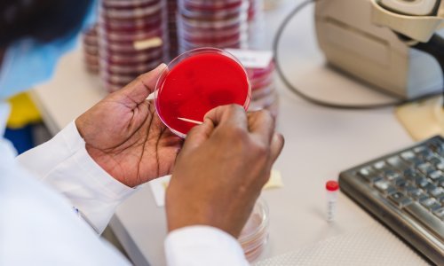 Nakon bolesti srca, bakterijske infekcije drugi su najveći uzrok smrti u svijetu. Ovo su dvije najsmrtonosnije bakterije