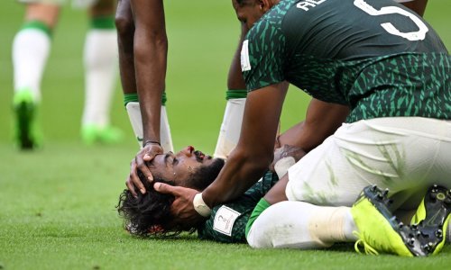 [FOTO] Njegova je ozljeda šokirala svijet, a sada stižu vijesti o posljedicama. Nesretni Saudijac mora na operaciju