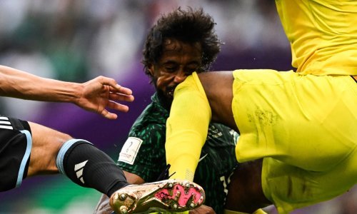 Pojavila se rendgenska snimka lica nesretnog Saudijca; posljedice sudara su itekako vidljive