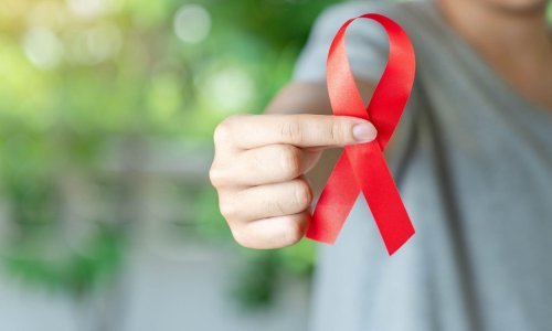 Nakon promjene naziva majmunskih boginja stiže inicijativa i za promjenom naziva HIV, ta bolest više ne mora biti smrtonosna