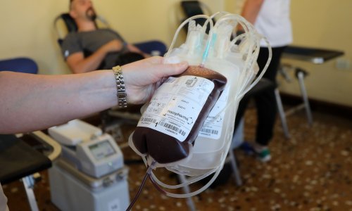 S Trasnfuzije apeliraju: Pacijenti diktiraju stanje zaliha, trenutno je pojačani trend potražnje A pozitivne krvne grupe