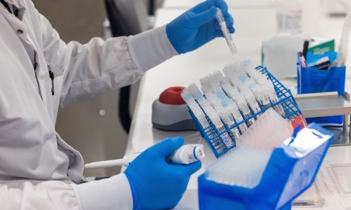 U Hrvatskoj je 130 novih slučaja zaraze, osam osoba preminulo