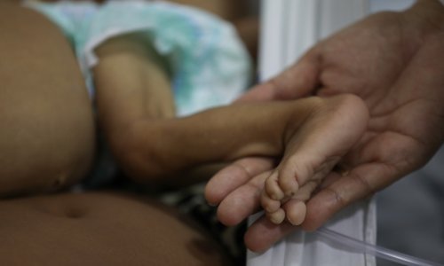 Više desetaka domorodačke djece u Brazilu završilo u bolnici zbog pothranjenosti