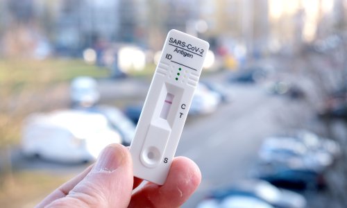 Nova 64 slučaja koronavirusa, pet osoba umrlo