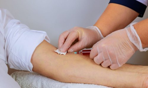 Kad je dobio dijagnozu, doktor mu je rekao: 'Zajedno ćemo doživjeti da se HIV može izliječiti'; sad se to i dogodilo