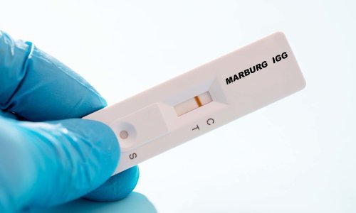 Španjolske vlasti otkrile prvi sumnjivi slučaj marburške bolesti