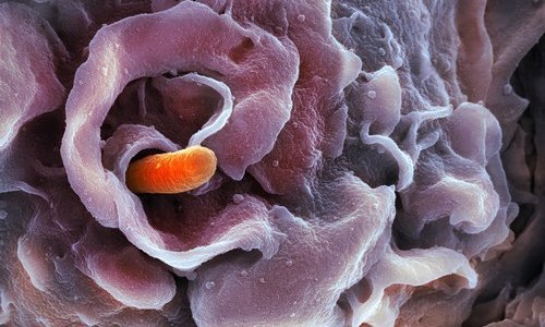 Stiglo važno upozorenje; raste broj slučajeva zaraze bakterijom otpornom na lijekove