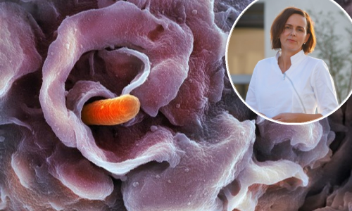 U Americi raste broj zaraženih šigelom: Kakvo je stanje kod nas i kakva je bolest u pitanju?