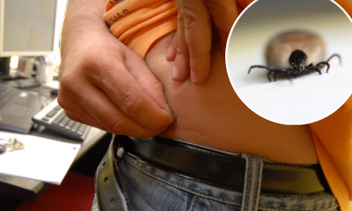 Zabilježena već četiri slučaja bolesti koje prenose krpelji, ovo su glavni simptomi