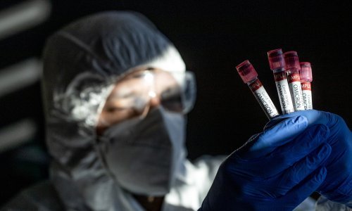 Novi soj koronavirusa dolazi s novim simptomima: To dosad nismo vidjeli